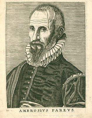 Paré, Ambroise<br>1509-1590<br>hugenottischer Mediziner
